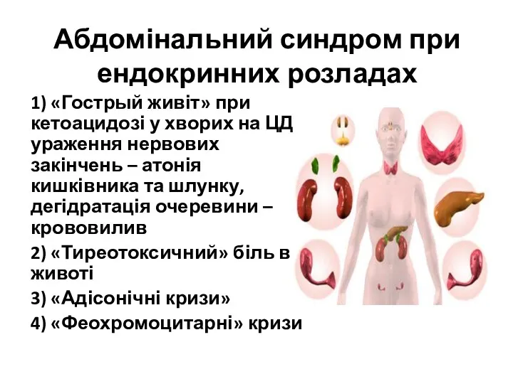 Абдомінальний синдром при ендокринних розладах 1) «Гострый живіт» при кетоацидозі