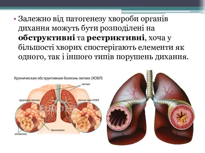 Залежно від патогенезу хвороби органів дихання можуть бути розподілені на