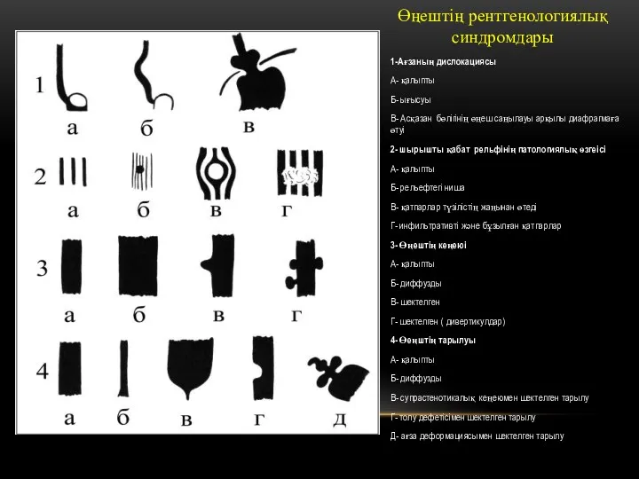 Өңештің рентгенологиялық синдромдары 1-Ағзаның дислокациясы А- қалыпты Б- ығысуы В-