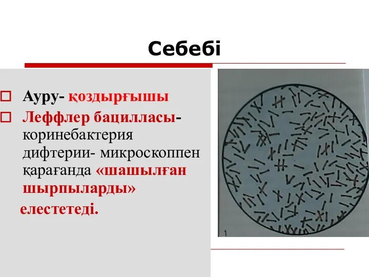 Себебі Ауру- қоздырғышы Леффлер бацилласы- коринебактерия дифтерии- микроскоппен қарағанда «шашылған шырпыларды» елестетеді.