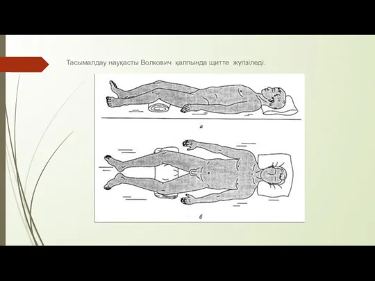 Тасымалдау науқасты Волкович қалпында щитте жүгізіледі.