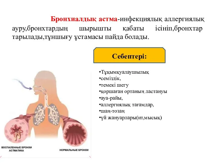 Бронхиалдық астма-инфекциялық аллергиялық ауру,бронхтардың шырышты қабаты ісініп,бронхтар тарылады,тұншығу ұстамасы пайда