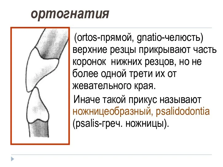 ортогнатия (ortos-прямой, gnatio-челюсть) верхние резцы прикрывают часть коронок нижних резцов,