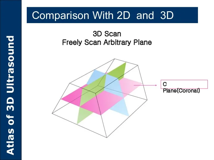 3D Scan Freely Scan Arbitrary Plane C Plane(Coronal) Comparison With 2D and 3D