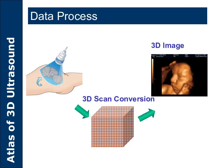 Data Process 3D Scan Conversion 3D Image