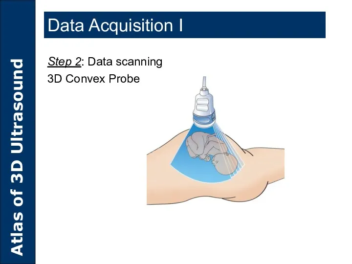 Step 2: Data scanning 3D Convex Probe Data Acquisition I