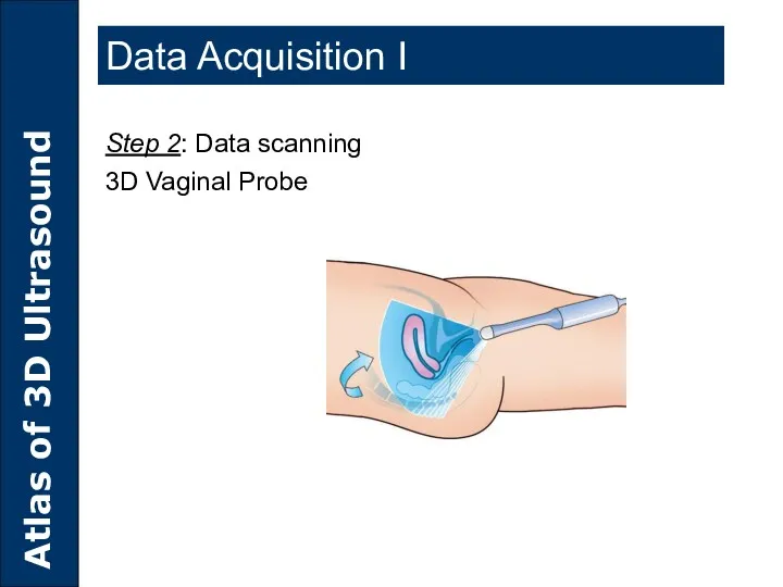 Data Acquisition I Step 2: Data scanning 3D Vaginal Probe