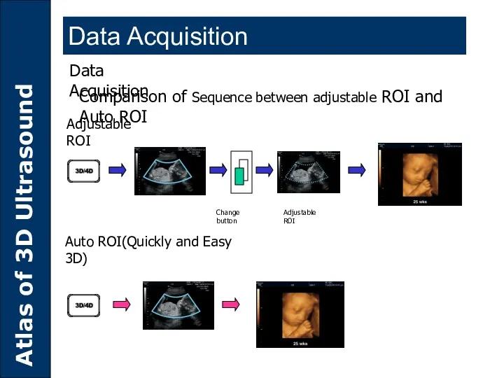 Data Acquisition Comparison of Sequence between adjustable ROI and Auto