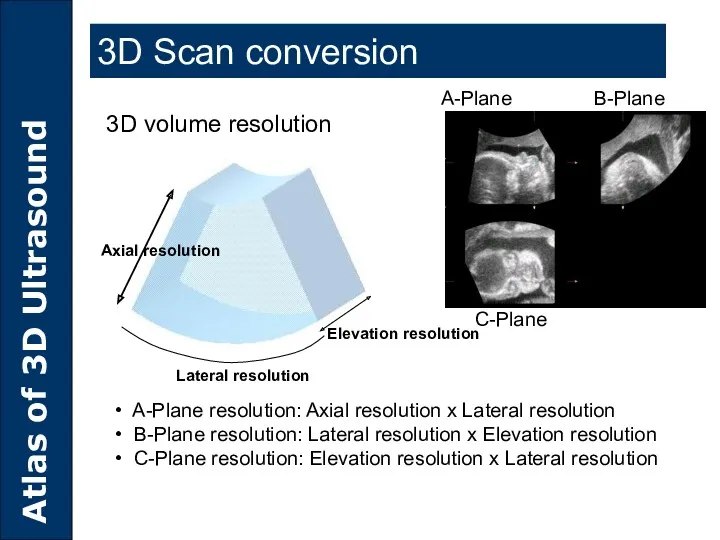 A-Plane resolution: Axial resolution x Lateral resolution B-Plane resolution: Lateral