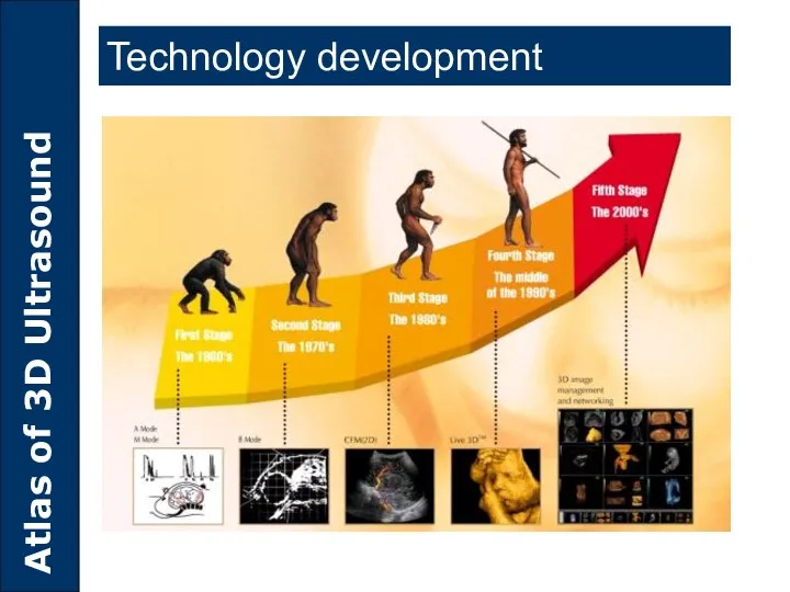 Technology development