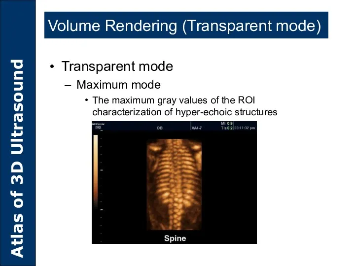 Volume Rendering (Transparent mode) Transparent mode Maximum mode The maximum