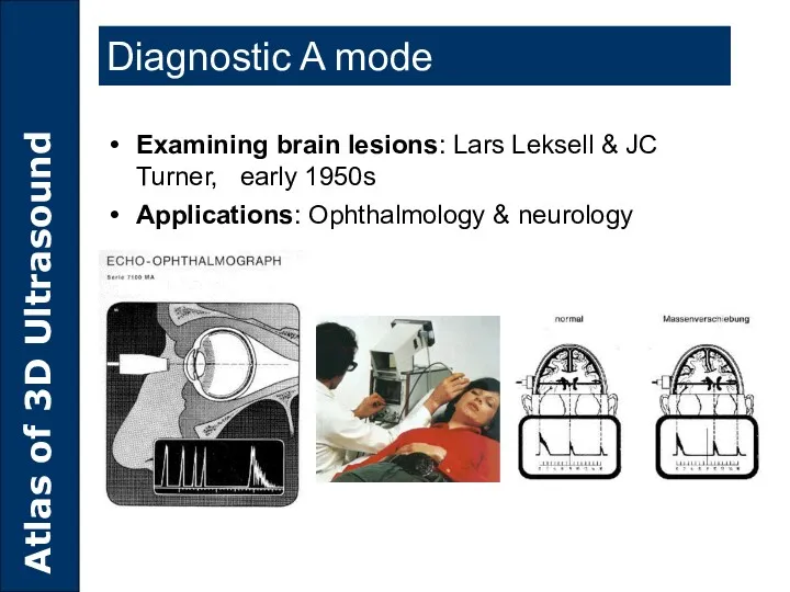Diagnostic A mode Examining brain lesions: Lars Leksell & JC