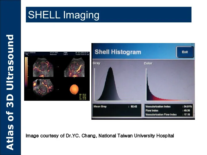 SHELL Imaging Image courtesy of Dr.YC. Chang, National Taiwan University Hospital