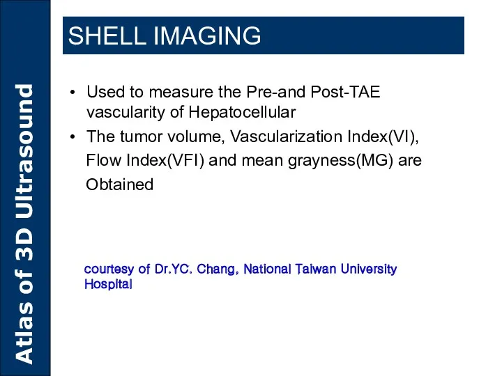 Used to measure the Pre-and Post-TAE vascularity of Hepatocellular The
