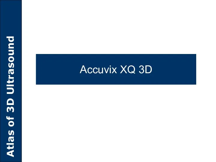 Accuvix XQ 3D
