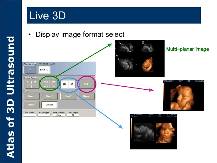 Multi-planar image Display image format select Live 3D