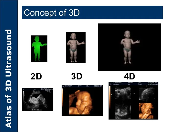 2D 3D 4D Concept of 3D