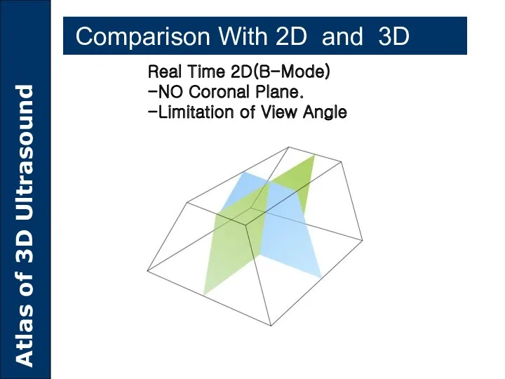 Real Time 2D(B-Mode) -NO Coronal Plane. -Limitation of View Angle Comparison With 2D and 3D