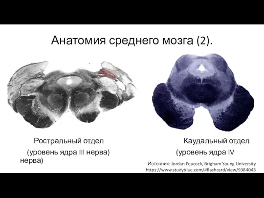 Анатомия среднего мозга (2). Ростральный отдел Каудальный отдел (уровень ядра III нерва) (уровень