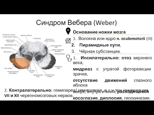 Основание ножки мозга 1. Волокна или ядро n. oculomotorii (III) Пирамидные пути, Чёрная