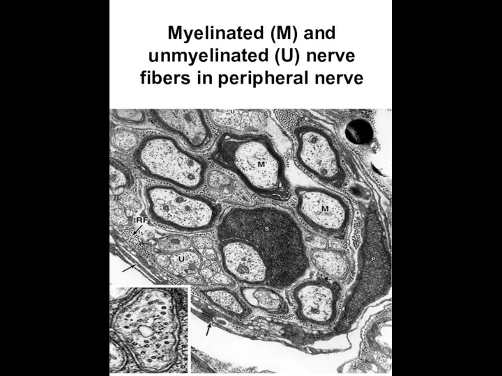 Myelinated (M) and unmyelinated (U) nerve fibers in peripheral nerve