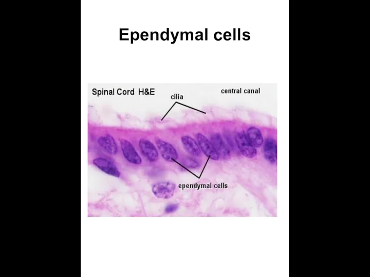 Ependymal cells