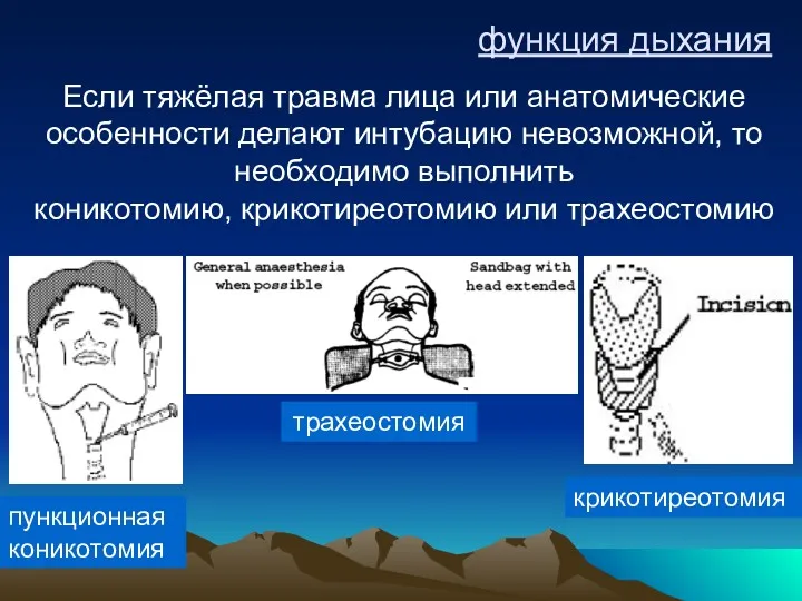 функция дыхания Если тяжёлая травма лица или анатомические особенности делают