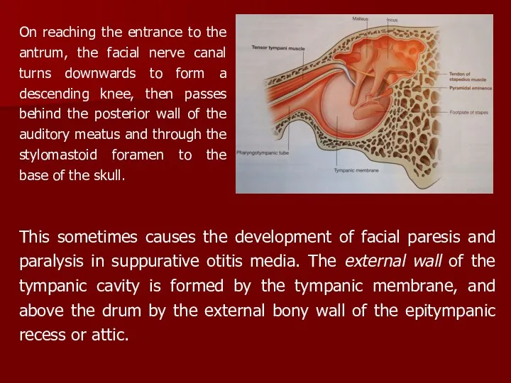 On reaching the entrance to the antrum, the facial nerve