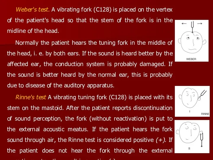 Weber's test. A vibrating fork (C128) is placed on the