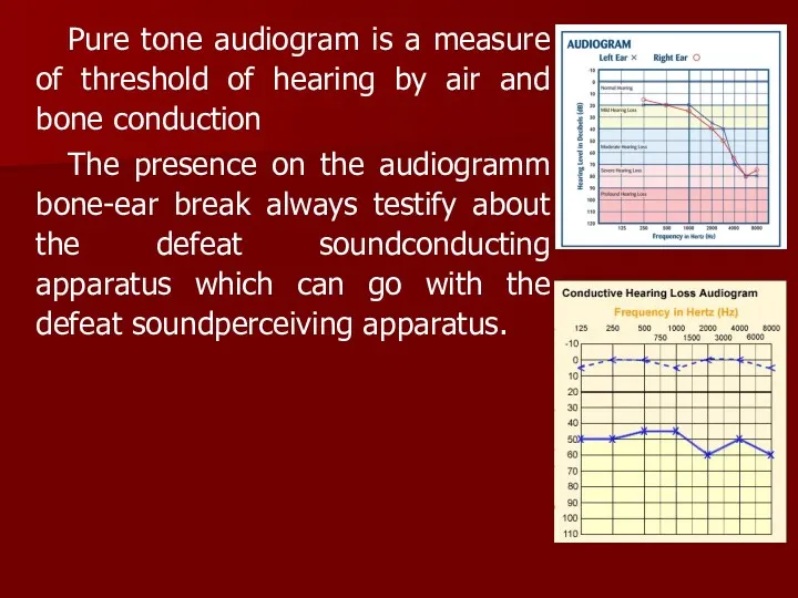 Pure tone audiogram is a measure of threshold of hearing