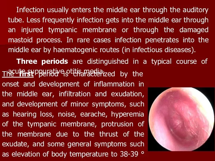 Infection usually enters the middle ear through the auditory tube.