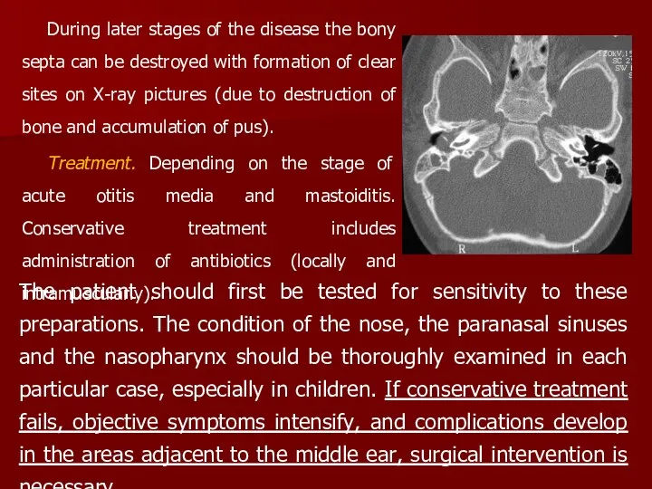 During later stages of the disease the bony septa can