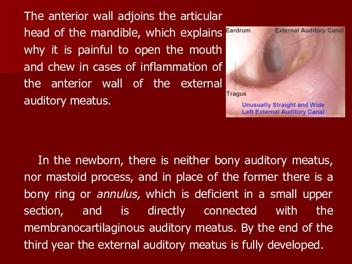 The anterior wall adjoins the articular head of the mandible,
