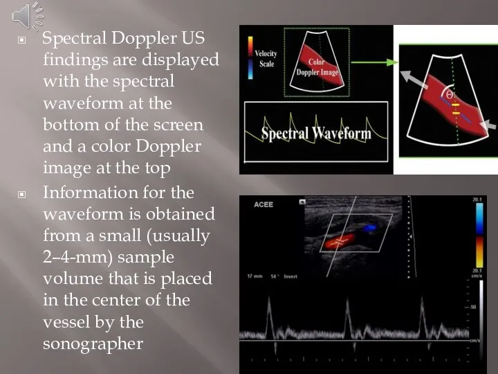 Spectral Doppler US findings are displayed with the spectral waveform