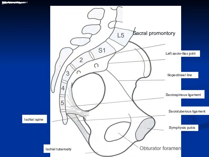 L4 Ischial spine Ischial tuberosity 48 Sacral promontory Left sacro-iliac