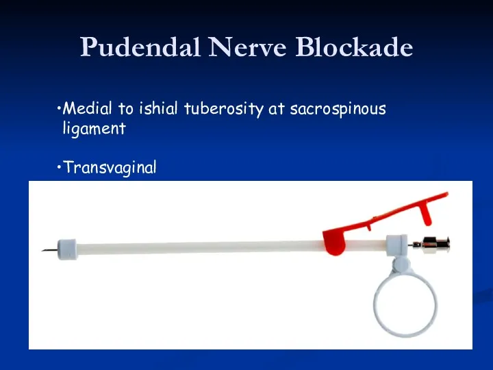 Pudendal Nerve Blockade Medial to ishial tuberosity at sacrospinous ligament Transvaginal