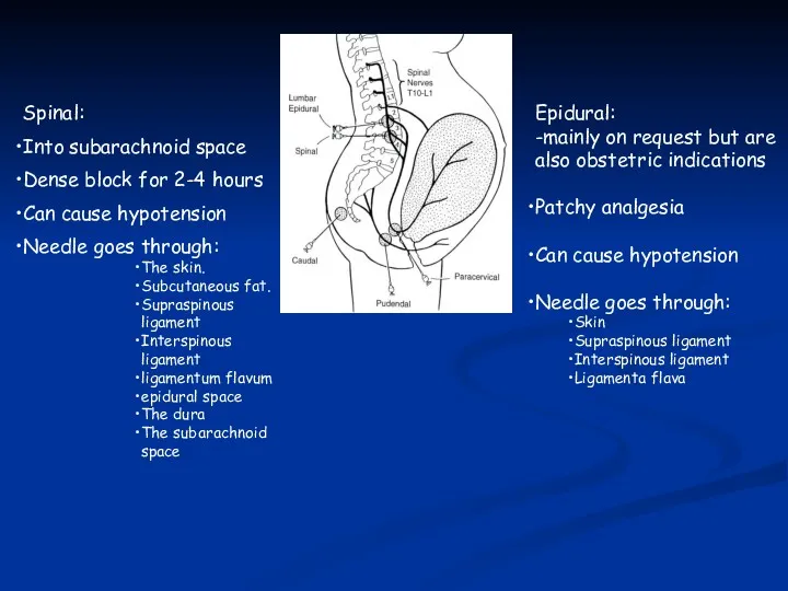 Spinal: Into subarachnoid space Dense block for 2-4 hours Can
