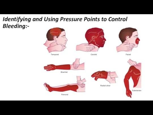 Identifying and Using Pressure Points to Control Bleeding:-