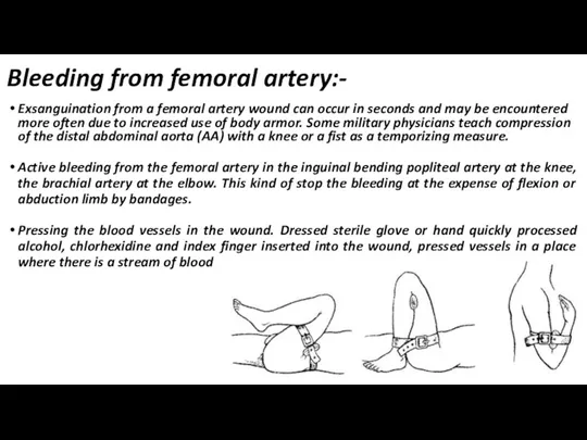 Bleeding from femoral artery:- Exsanguination from a femoral artery wound