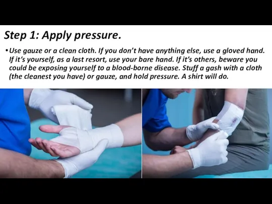 Step 1: Apply pressure. Use gauze or a clean cloth.