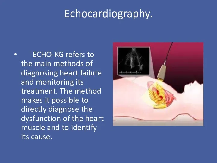 Echocardiography. ECHO-KG refers to the main methods of diagnosing heart