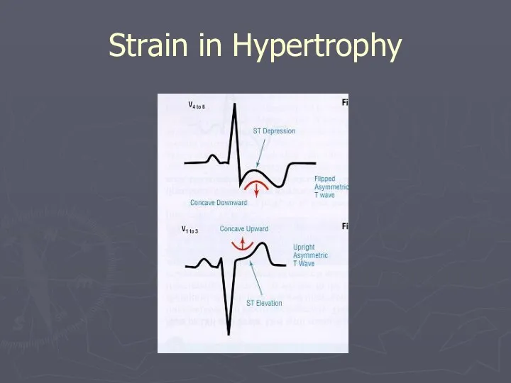 Strain in Hypertrophy
