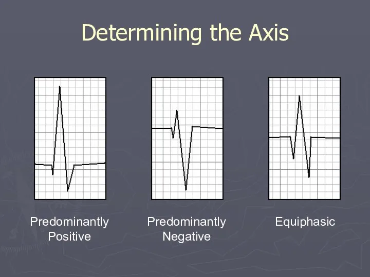 Determining the Axis Predominantly Positive Predominantly Negative Equiphasic