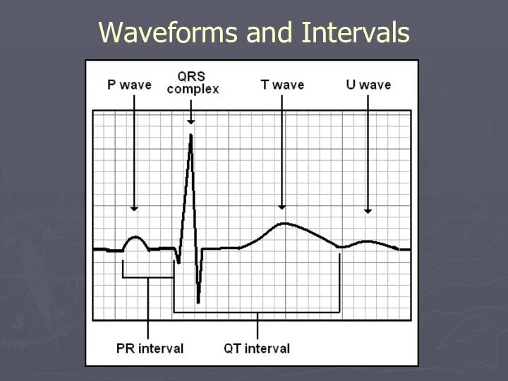Waveforms and Intervals