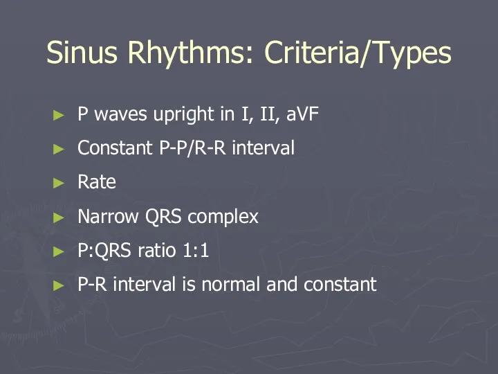 Sinus Rhythms: Criteria/Types P waves upright in I, II, aVF