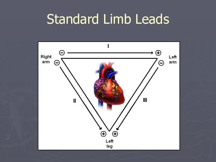 Standard Limb Leads