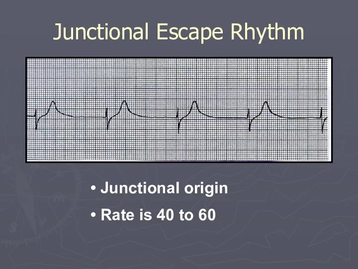 Junctional Escape Rhythm Junctional origin Rate is 40 to 60