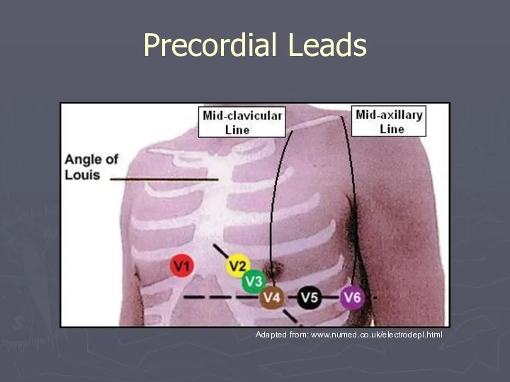 Precordial Leads Adapted from: www.numed.co.uk/electrodepl.html