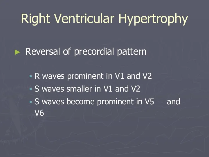 Right Ventricular Hypertrophy Reversal of precordial pattern R waves prominent