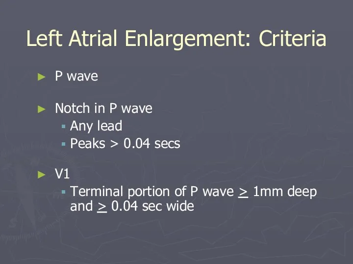 Left Atrial Enlargement: Criteria P wave Notch in P wave